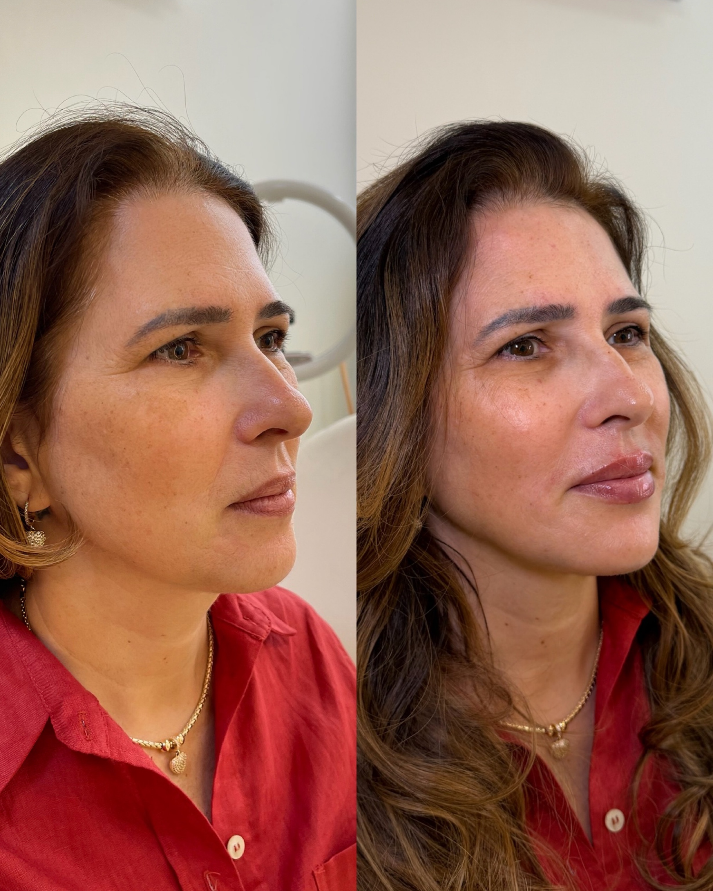 Antes e depois — Método Manzini · Caso 03