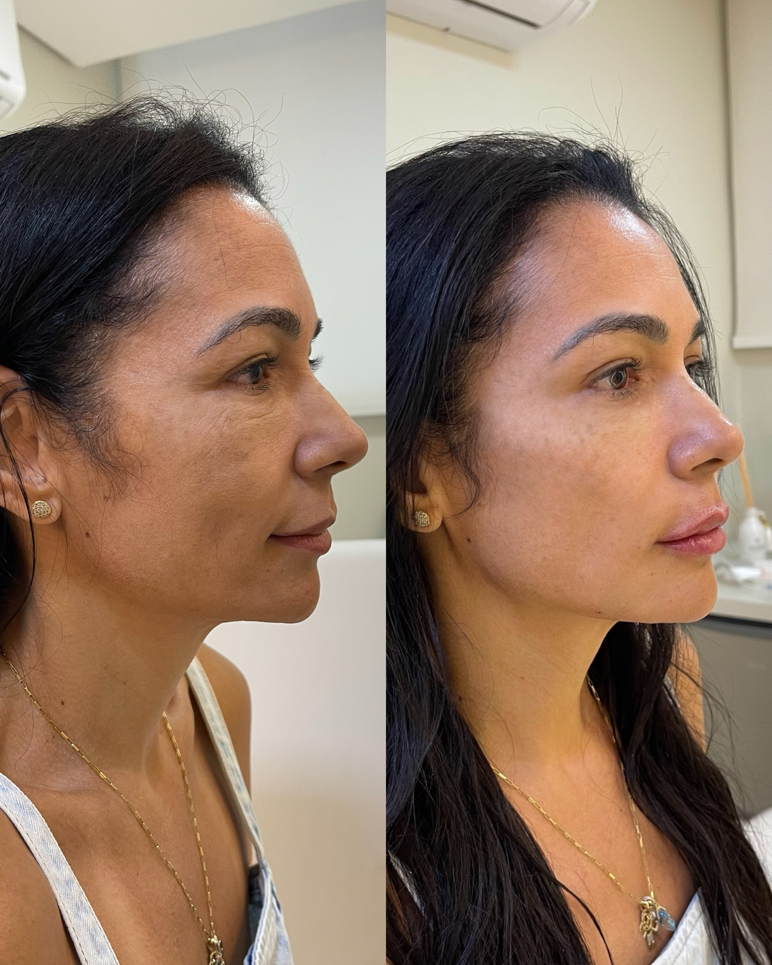 Antes e depois — Método Manzini · Caso 05