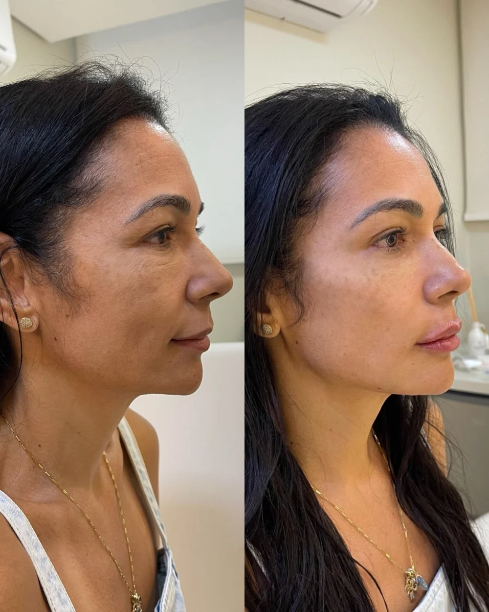 Antes e depois — Método Manzini · Caso 05